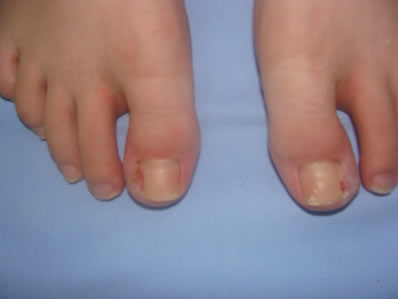 http://image.nauka.bg/bio/med/lozanov/Silben%20nano,%20Aquacel%20AG_4.jpg