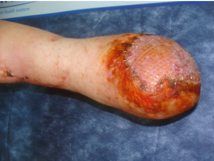 http://image.nauka.bg/bio/med/lozanov/anpotacia1.jpg