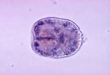 http://upload.wikimedia.org/wikipedia/commons/e/e8/Echinococcus_granulosus_scolex.jpg